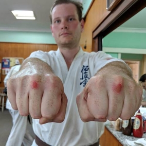 Skinned knuckles
